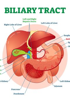 Navigating Biliary Tract Disorders: Understanding, Diagnosing, and Managing