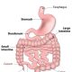 Comprehensive Care for a Client with Upper Gastrointestinal Tract Health Problems: An NCLEX-Standard Guide