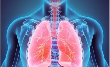 Mastering Chronic Obstructive Pulmonary Disease (COPD) for the NCLEX Exam