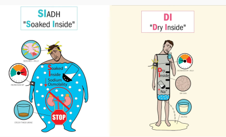 Mastering Diabetes Insipidus and SIADH in Preparation for NCLEX Exam