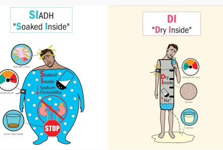 Mastering Diabetes Insipidus and SIADH in Preparation for NCLEX Exam