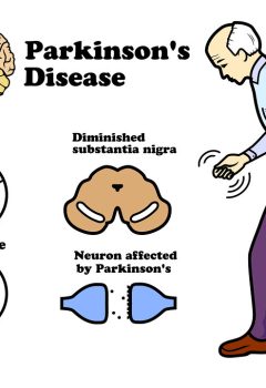 Parkinson’s Disease: Causes, Symptoms, and Care – NCLEX Guide