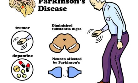 Parkinson’s Disease: Causes, Symptoms, and Care – NCLEX Guide