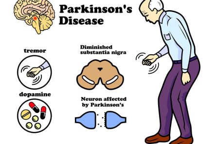 Parkinson’s Disease: Causes, Symptoms, and Care – NCLEX Guide