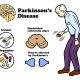 Parkinson’s Disease: Causes, Symptoms, and Care – NCLEX Guide