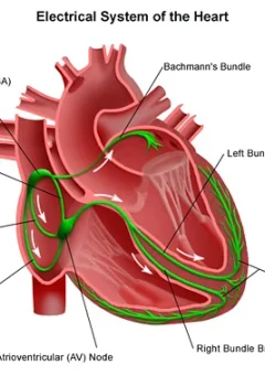 Understanding Dysrhythmias (Arrhythmias) for the NCLEX Exam