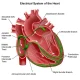 Understanding Dysrhythmias (Arrhythmias) for the NCLEX Exam