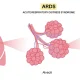 Acute Respiratory Distress Syndrome (ARDS): A Guide for NCLEX Exam Preparation