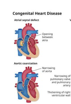 CONGENITAL HEART DEFECTS IN CHILDREN: NCLEX-STYLE QUESTIONS AND KEY NURSING INTERVENTIONS