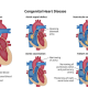 CONGENITAL HEART DEFECTS IN CHILDREN: NCLEX-STYLE QUESTIONS AND KEY NURSING INTERVENTIONS