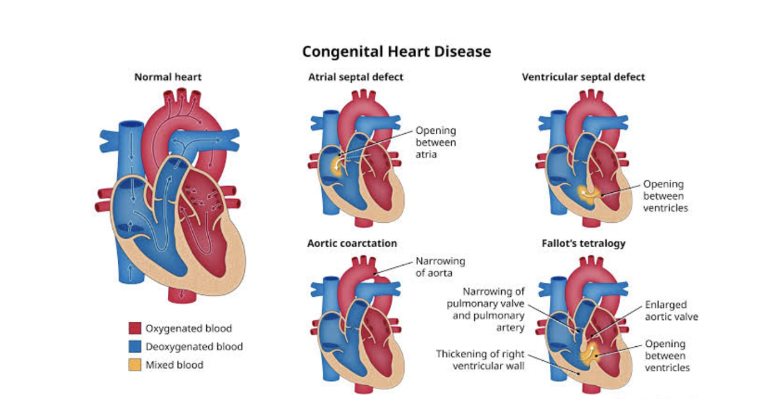 CONGENITAL HEART DEFECTS IN CHILDREN: NCLEX-STYLE QUESTIONS AND KEY NURSING INTERVENTIONS