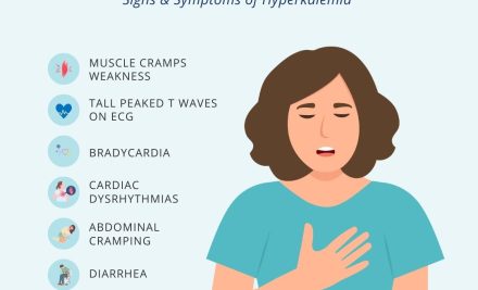 Hyperkalemia (High Potassium > 5.0 mEq/L): What Every NCLEX Test-Taker Should Know